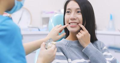Composite Fillings and Bonding in Harrisonburg, VA